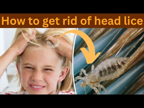 Home Remedies To Get Rid Of Head Lice