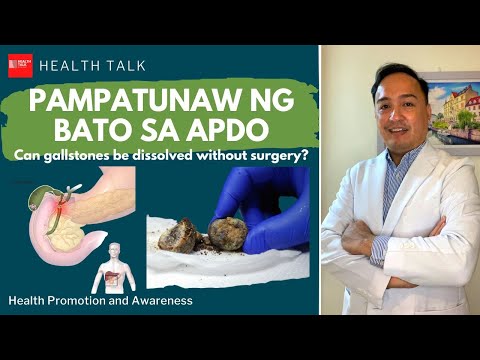 Thumbnail for Pampatunaw ng bato sa Apdo (Can gallstones be dissolved without surgery?)