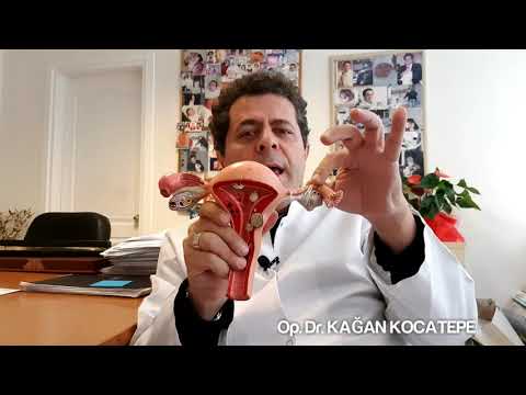 Dış gebelik nasıl oluşur ve tanı konur, neden kürtaj gerekir, ne zaman ilaç veya ameliyat gerekir?