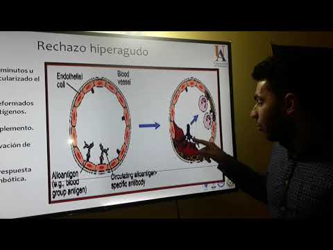 Thumbnail for Fisiopatología del rechazo en trasplante de órganos.