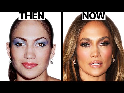 Jennifer Lopez NEW FACE | Plastic Surgery Analysis