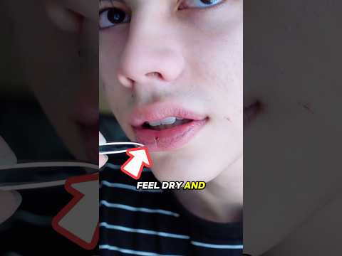 Thumbnail for How to Fix Dry Lips in Seconds! ????