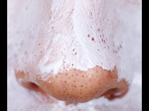 Beyaz Tutkal ile Siyah Noktalarınıza Veda Edin (Kesin Çözüm) | Beyza Sultan&apos;s