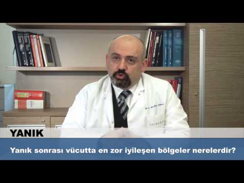 Yanık sonrası vücutta en zor iyileşen bölgeler nerelerdir?