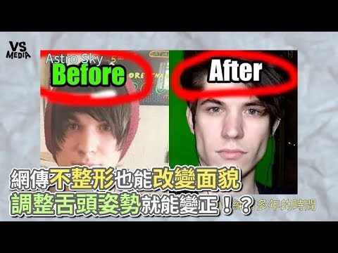 網傳不整形也能改變面貌 調整舌頭姿勢就能變正！？《VS MEDIA》