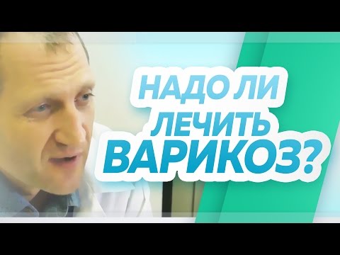 Надо ли лечить варикозно расширенные вены (варикоз) на ногах? Флебологический центр &quot;Антирефлюкс&quot;