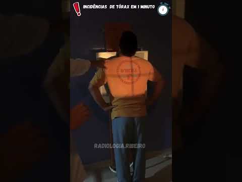 Incidências básicas para raios-x de Tórax ☢️