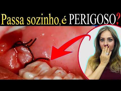 ????DOR no (DENTE DO LADO) da Cirurgia, é normal? Extrai o dente (SISO) e o dente do lado está doendo