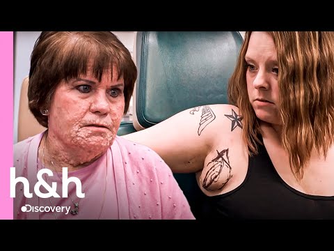 SIN CENSURA: 3 Cirugías de alto impacto | Dra. Sandra Lee: Especialista en piel | Discovery H&H