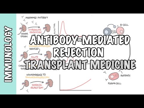 Thumbnail for Transplant Medicine - Antibody mediated rejection