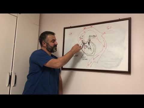 Aort Anevrizması (Genişlemesi) ve Aort Yetmezliği – Prof. Dr. Ahmet Akgül