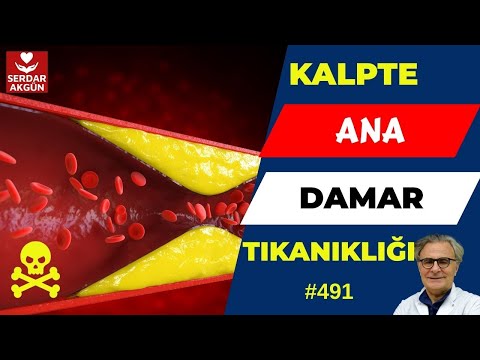 491. Kalpte Ana Damar nedir? Ana damar tıkanıklığı?, Sağlık Videoları, Serdar Akgün