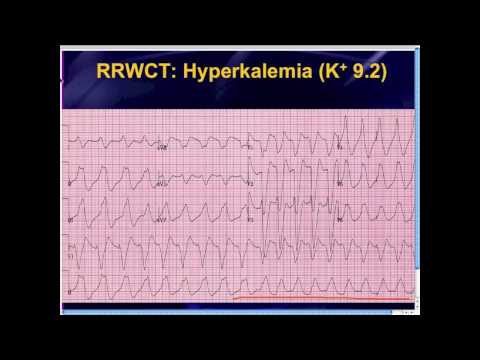 EMRAPTV136 Really WIDE QRS