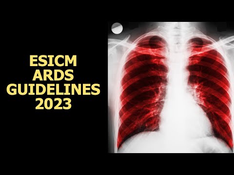 Thumbnail for ESICM Guidelines for ARDS  2023
