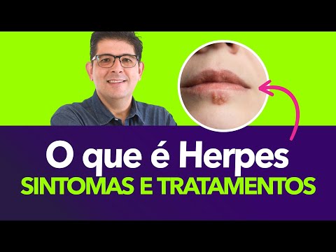 Thumbnail for Herpes: tipos, sintomas e tratamentos | Dr Juliano Teles