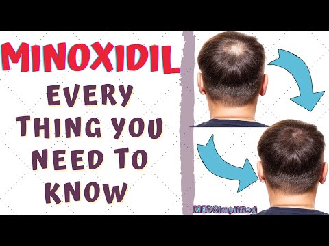 DOES MINOXIDIL REALLY TREAT HAIRFALL??