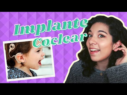 Thumbnail for TODO LO QUE TIENES QUE SABER SOBRE EL IMPLANTE COCLEAR ????????