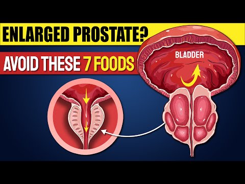 Thumbnail for 7 Foods To AVOID with an ENLARGED PROSTATE