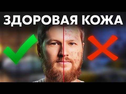 Thumbnail for Как избавиться от ПРЫЩЕЙ? Здоровая кожа