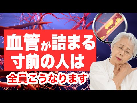 血管が詰まる寸前の人にだけ現れる症状