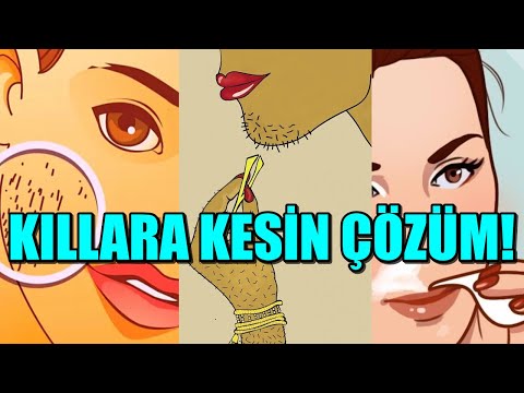 Thumbnail for BİR TÜRLÜ KURTULAMADIĞINIZ KILLAR BUNUNLA YOK OLUYOR! HEMEN KULLANMAYA BAŞLAYIN!