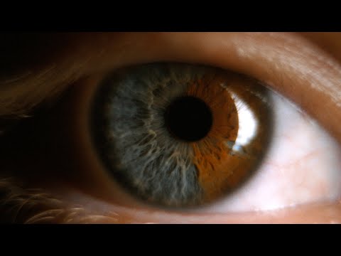 SEVER - My Dream, My Agony (OFFICIAL MUSIC VIDEO)