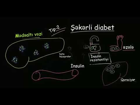 Patofiziologiya - II tip diabet