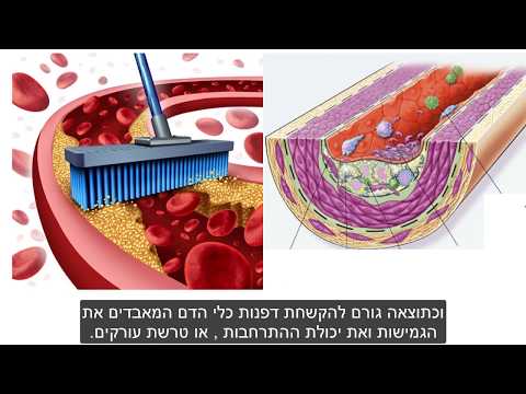 לחץ דם בריא ומאוזן,  בטבעיות, ללא תרופות וכדורים - ד&quot;ר שמי שגיב כירופרקט