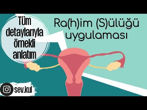Ra(h)im (s)ülüğü uygulaması örnekli anlatım..