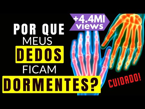 10 CAUSAS DE DORMÊNCIAS NAS MÃOS E DEDOS | Tem FORMIGAMENTO e DOR nas mãos e dedos? CUIDADO!