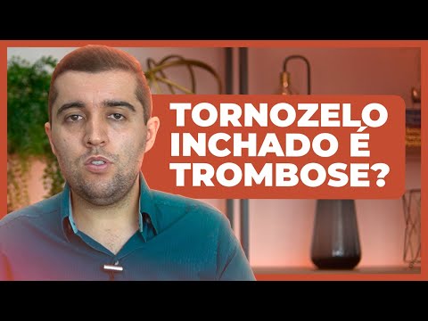 Será que tornozelo inchado é trombose, ou pode ser algo ainda mais grave? Tem risco alto de embolia?