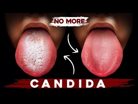 Thumbnail for A Better Way to Eliminate Candida for Good