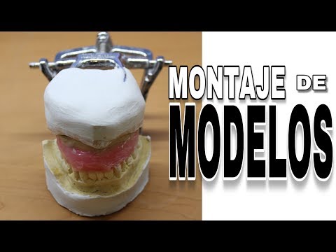 MONTAJE DE MODELOS DENTALES EN ARTICULADOR DE BISAGRA PASO A PASO