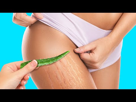 20+ MAGICAL REMEDIES WITH ALOE