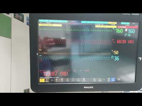 Fluke Prosim 8, Philips MX800 & X3 with Neonatal Manikin
