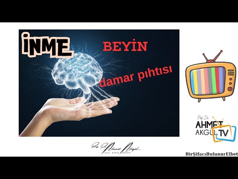 Thumbnail for İskemik İnme (Beyne Pıhtı Atması) Kimleri Tehdit Ediyor? - Prof. Dr. Ahmet AKGÜL