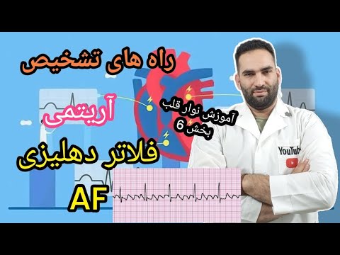 چگونه  فلاتر دهلیزی رو تشخیص بدهیم؟#شایع ترین آریتمی قلبی