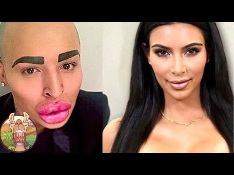 Thumbnail for 10 Personnes OBSÉDÉES  Par La Chirurgie Esthétique  | Lama Faché