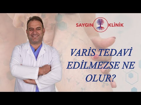 Varis Tedavi Edilmezse Ne Olur?
