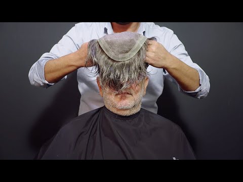 Protez Saç Uygulaması - Nüvit&apos;in Hairplus Saç Protezi ile Büyük Değişimi