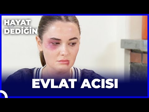 Hayat Dediğin -  Evlat Acısı