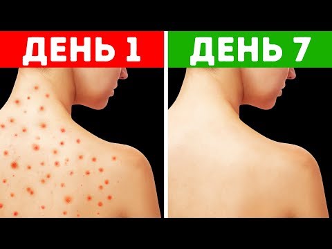 Thumbnail for Как Избавиться от Проблем с Кожей, Просто Изменив Свои Пищевые Привычки