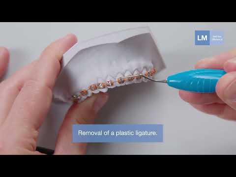 How to use LM™ Ligature On-Off SL instrument