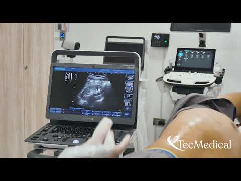 Thumbnail for ECOGRAFO SONOSCAPE E1 EXP