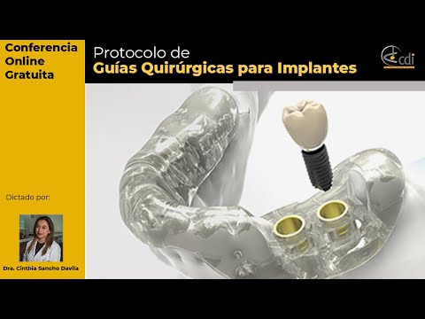 Conferencia "Protocolo de Guías Quirúrgicas para implantes."