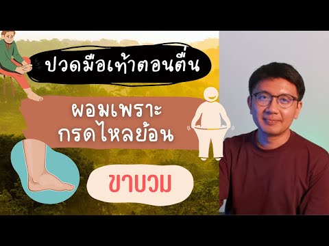 หลับไม่สนิท | ผอมเพราะกรดไหลย้อน | ขาบวม - หมอนัท ตอบคำถาม