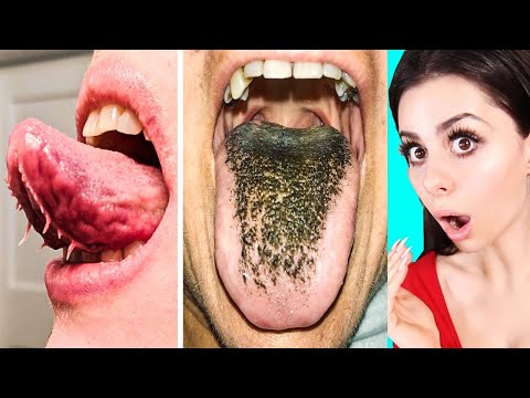 Thumbnail for Unique BODY FEATURES That Only 5% of People Have !