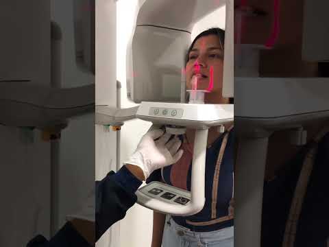 Não faça RAIO X antes de ver esse vídeo ????