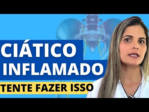 CIÁTICO INFLAMADO: Essa pode ser a causa da dor.