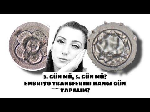 Thumbnail for 3. gün mü, 5. gün mü? Embriyo transferini hangi gün yapalım?